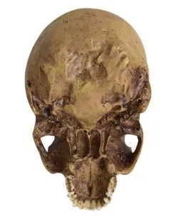 Antiker Totenschädel Ohne Unterkiefer 19cm -Grusel Dekor Geschaft antiker totenkopf ohne unterkiefer antiker totenschaedel ohne unterkiefer gothic deko 53262 04